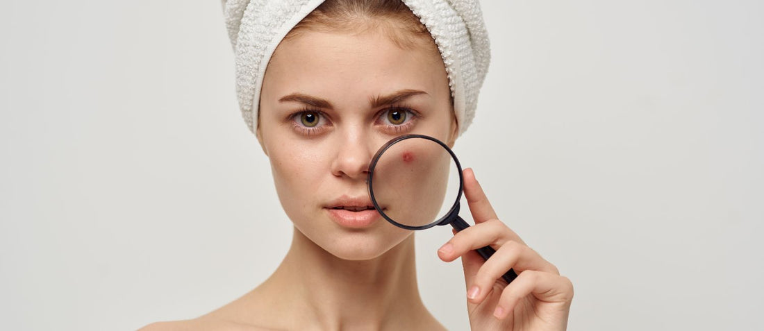 The number 1 thing you need to do to get rid of acne, eczema and other skin conditions