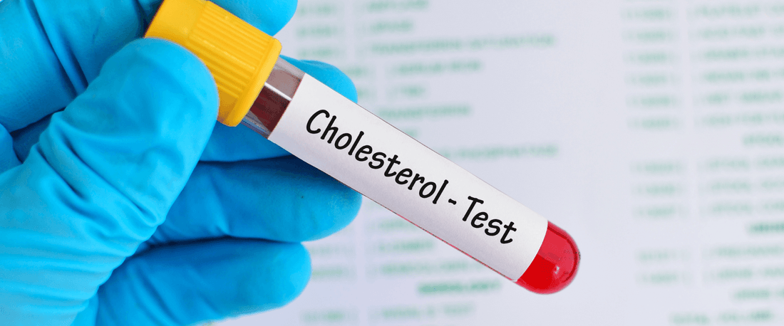 Cholesterol testing – a deeper look