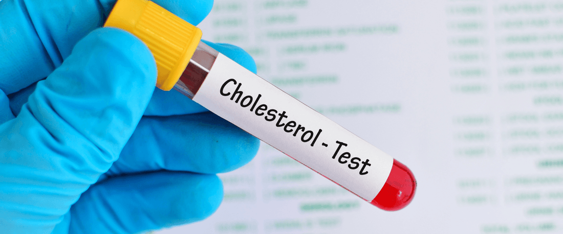 Cholesterol Testing – A Deeper Look – Vitamin G Nutraceuticals